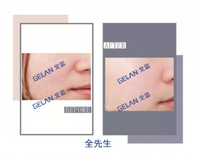 t(y)ĤNӹN Vݸ{(ln)